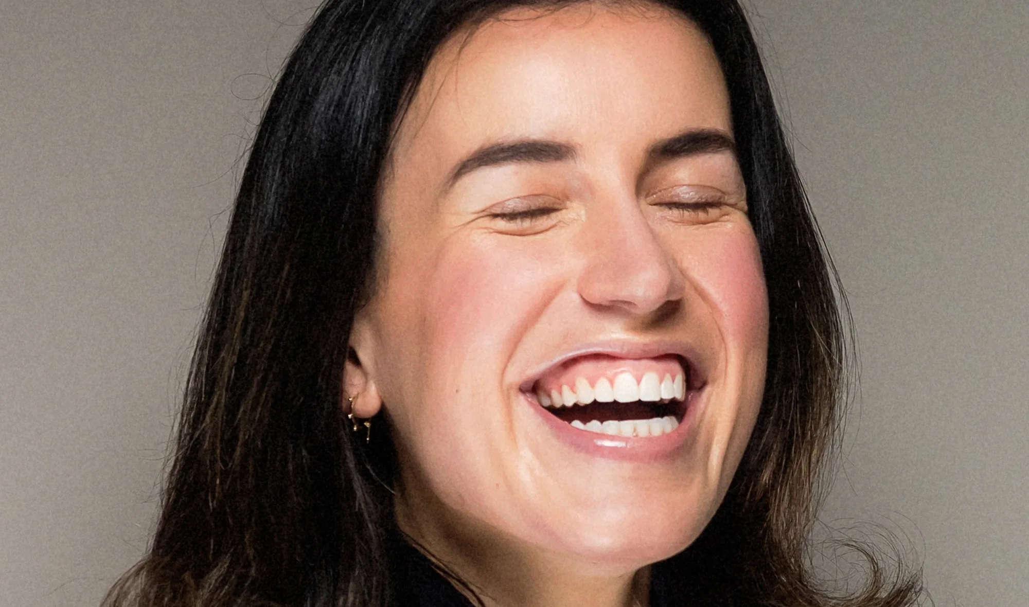 Patient smiling after cosmetic dental treatment at Queensway Dental