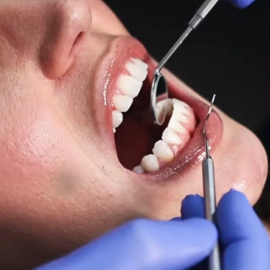 Periodontitis treatment and gum examination at Queensway Dental