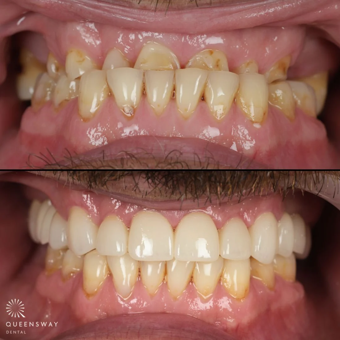 Restorative dental treatment at Queensway Dental