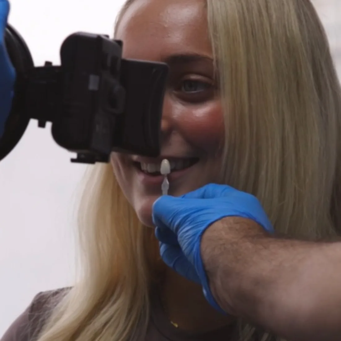 Shade-matching a patient's smile before whitening at Queensway Dental